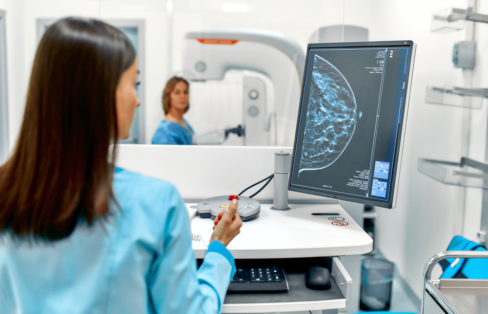 Avantajele mamografiei digitale 3D. Prin ce diferă de mamografia clasică?
